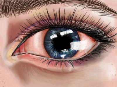 Eyeball, Optical, Cornea, Vision, Retina Drawing